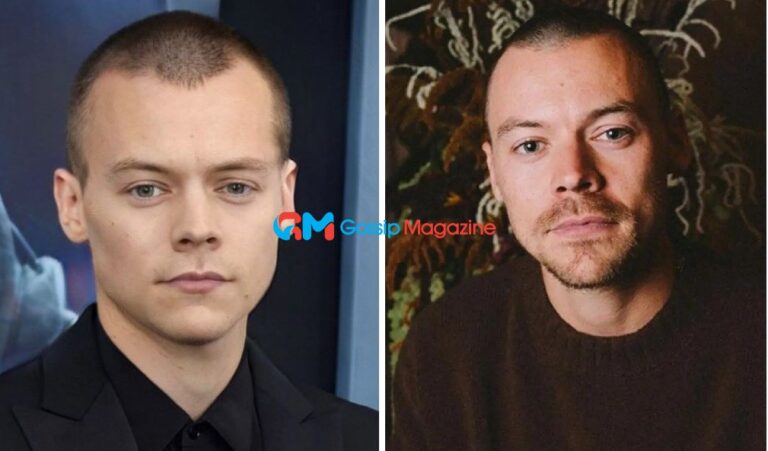 Harry Styles Bald: Rumors, Truths, and Speculations